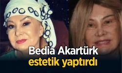 81 yaşındaki sanatçı Bedia Akartürk yüzünü gerdirdi