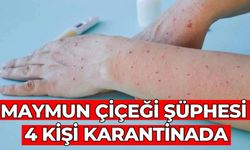 Maymun çiçeği şüphesi 4 kişi karantinada